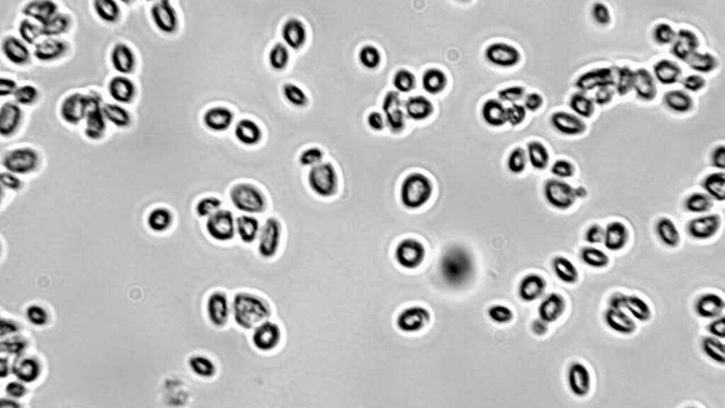 fermentation - yeast cells